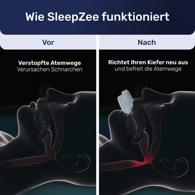 SleepZee image