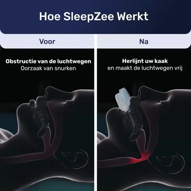 SleepZee image