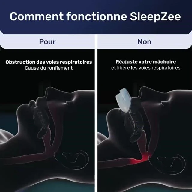 SleepZee image